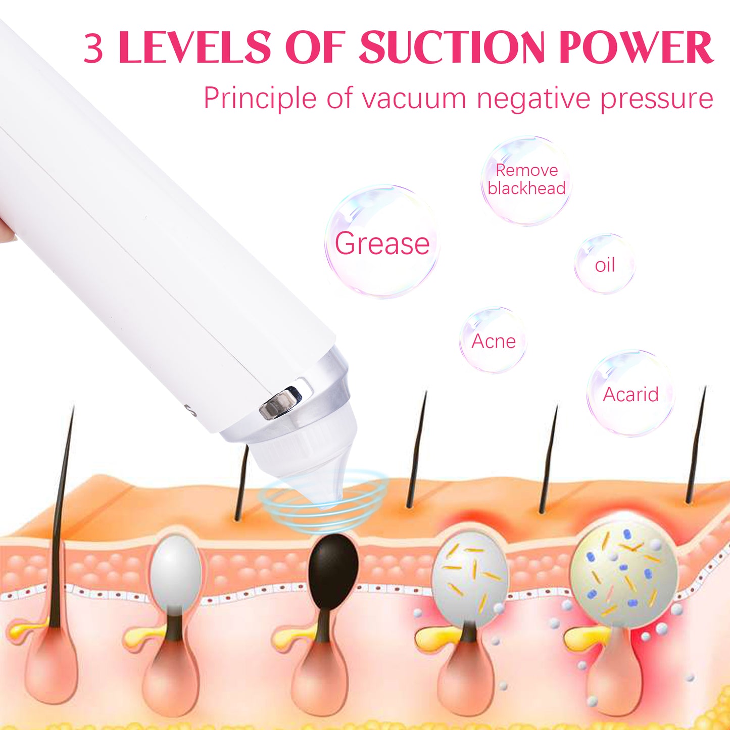 Vacuum Blackhead Remover with 6 Suction Heads, WIFI Visible Facial Pore Cleanser with HD Camera USB Rechargeable Electric Black head Suction Tool(No Shipment on Weekends) - Ballimart