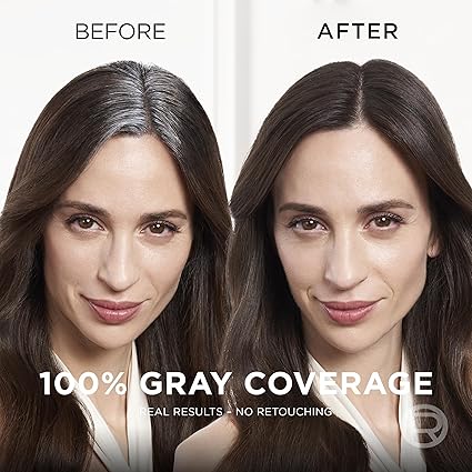 L'Oreal Paris Root Cover Up Spray - Temporary Gray Concealer for Dark Brown Hair, Lightweight, Ammonia-Free Formula for Seamless Coverage, Pack of 2