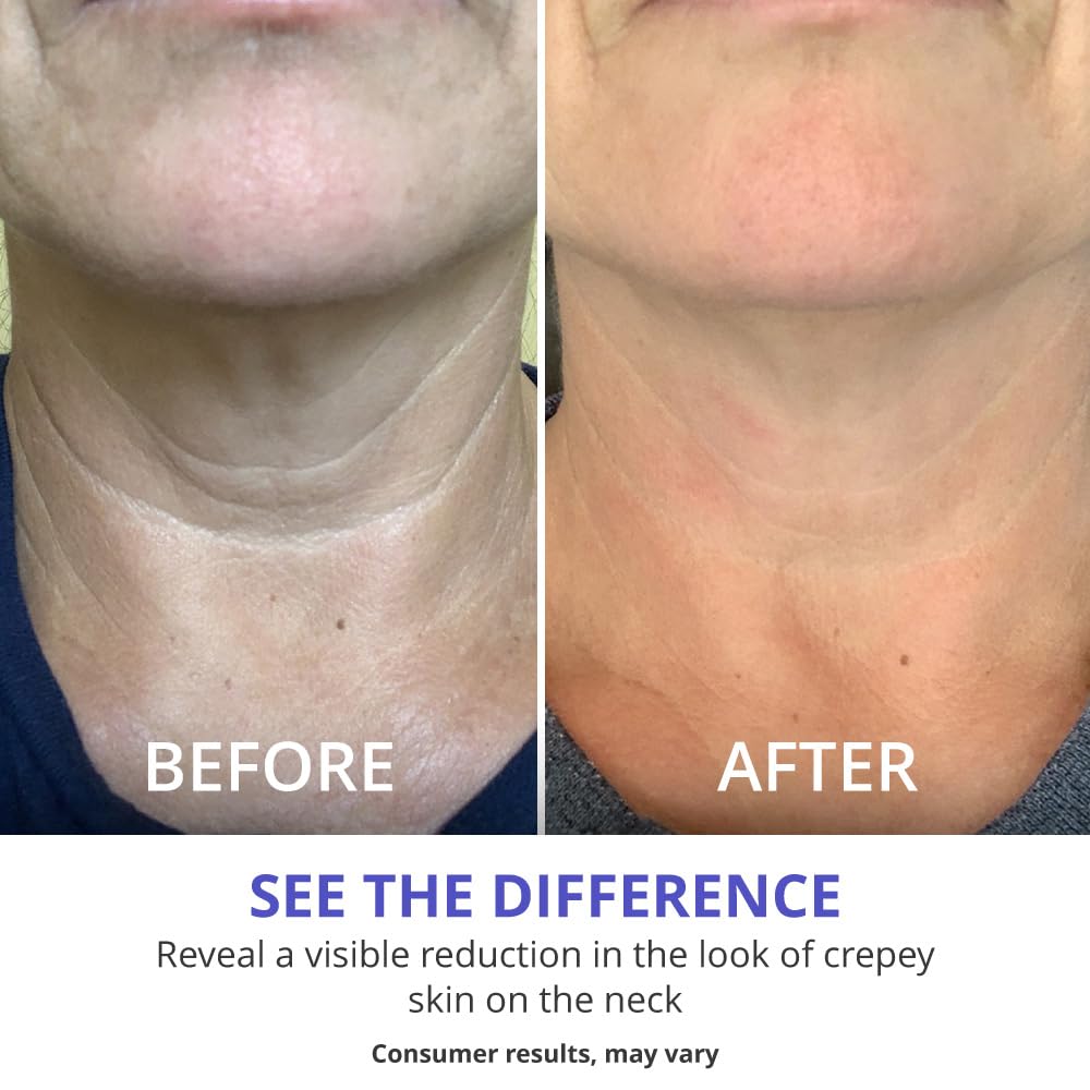 goPure Neck Firming Cream - Anti-Aging Cream for a Firmer, Smoother Neck & Chest | Pro-Active Firming Complex, 1.7 oz - Ballimart