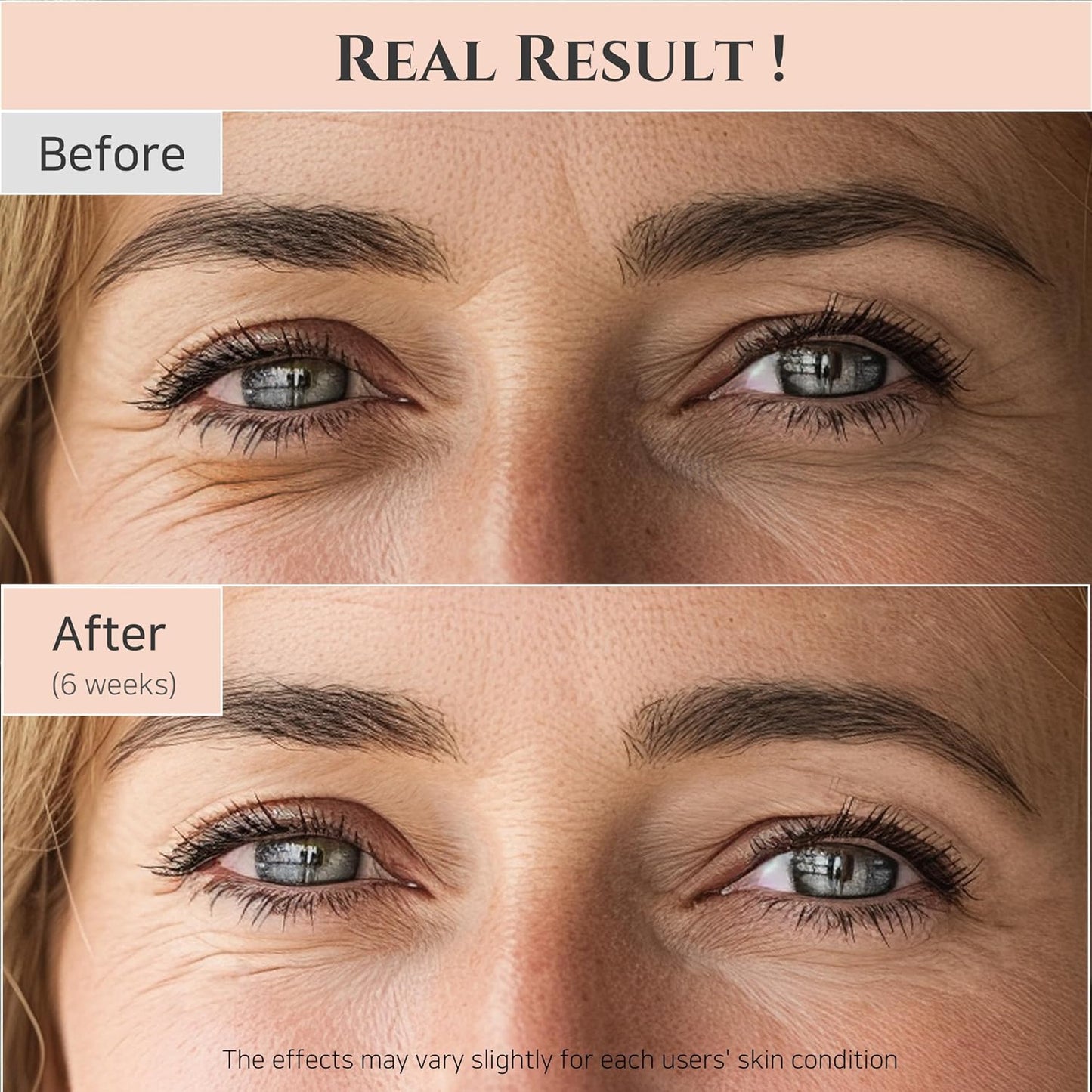 Beauty of Joseon Revive Eye Serum with Retinal & Niacinamide – 30ml (1 fl.oz) | Korean Anti-Aging Eye Care for Dark Circles, Fine Lines, & Wrinkles - Ballimart