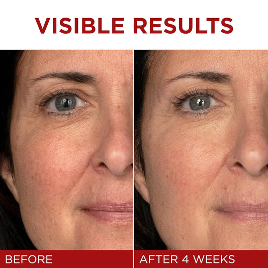 L'Oreal Paris Revitalift Triple Power Anti-Aging Face Moisturizer with Pro-Retinol, Hyaluronic Acid & Vitamin C, Fragrance-Free – 1.7 oz