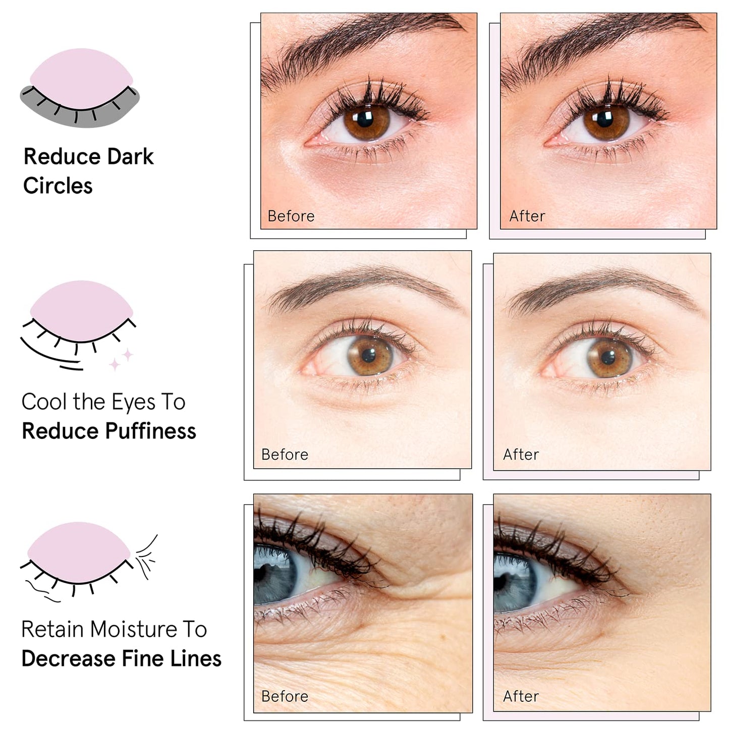 Grace & Stella Under Eye Mask (Gold, 24 Pairs) - Reduce Dark Circles & Puffy Eyes | Vegan & Cruelty-Free - Ballimart