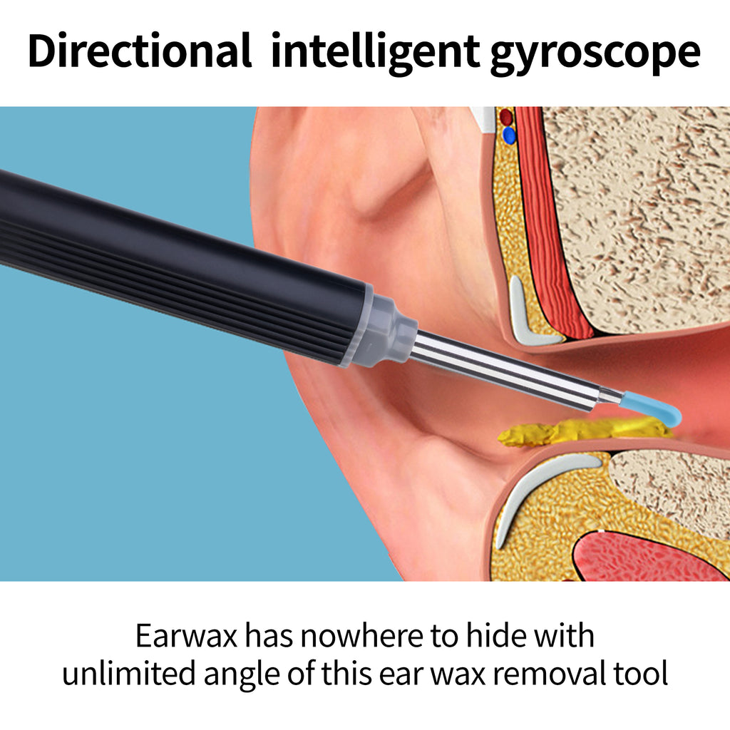 RALYUNI Ear Wax Removal Tool with Camera -Earwax Remover with 8 Pcs Ear Set - Earwax Removal Kit with Light - Ear Cleaner for iOS &Android Black(No delivery on weekends) - Ballimart
