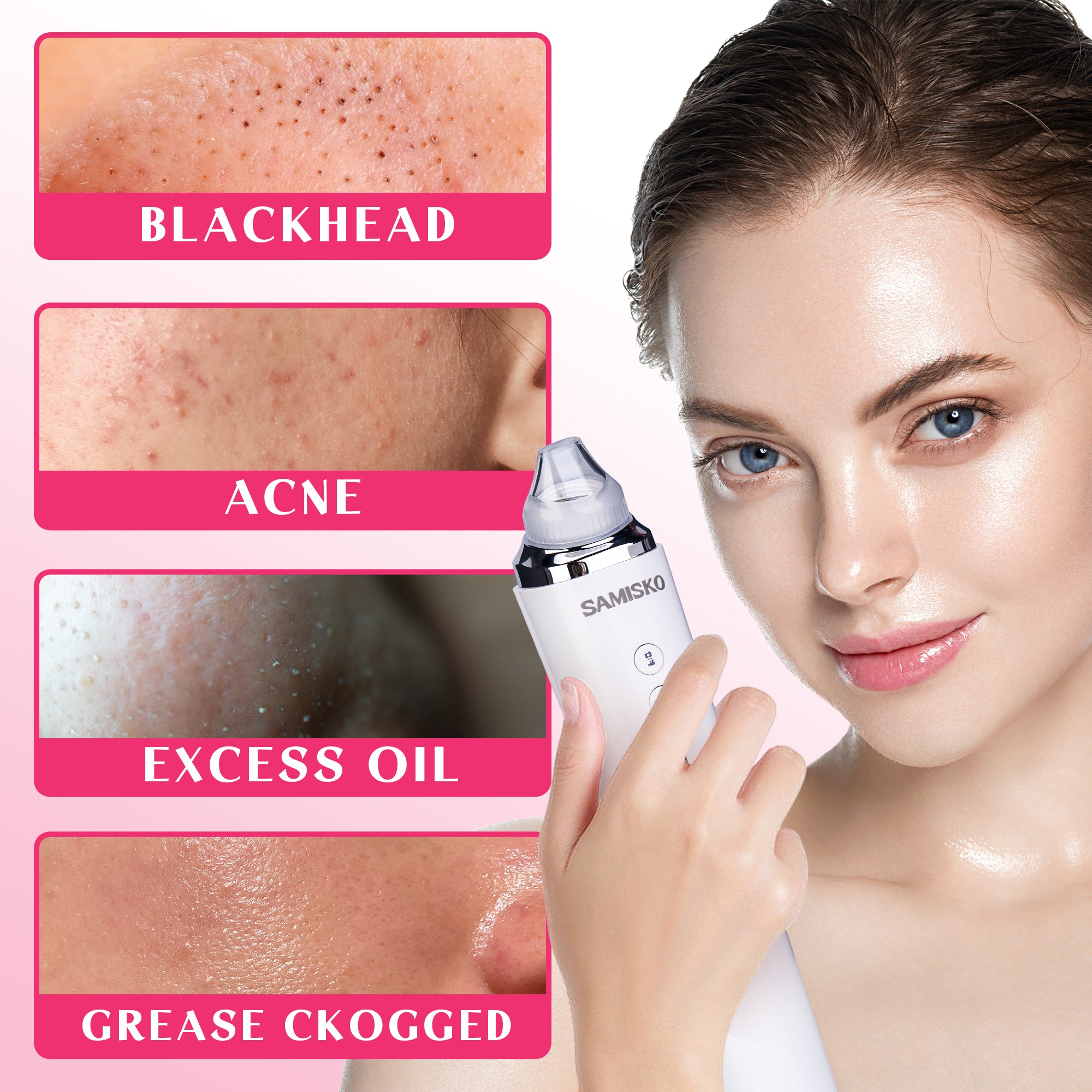 Vacuum Blackhead Remover with 6 Suction Heads, WIFI Visible Facial Pore Cleanser with HD Camera  USB Rechargeable Electric Black head Suction Tool(No Shipment on Weekends) - Ballimart