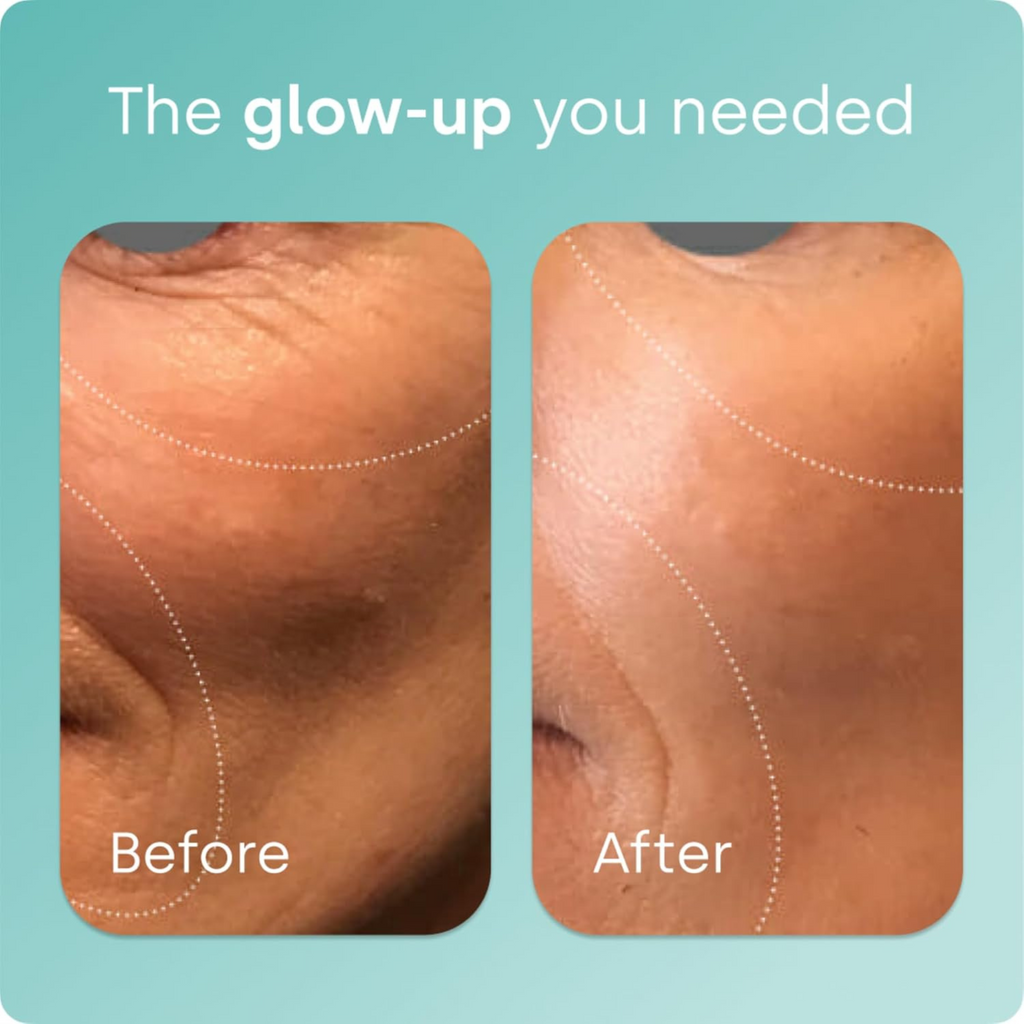 Biosil Collagen Booster – 120 Capsules – Patented ch-OSA for Skin, Hair, Nails & Joints – Supports Natural Collagen, Keratin & Elastin – Vegan & Non-GMO