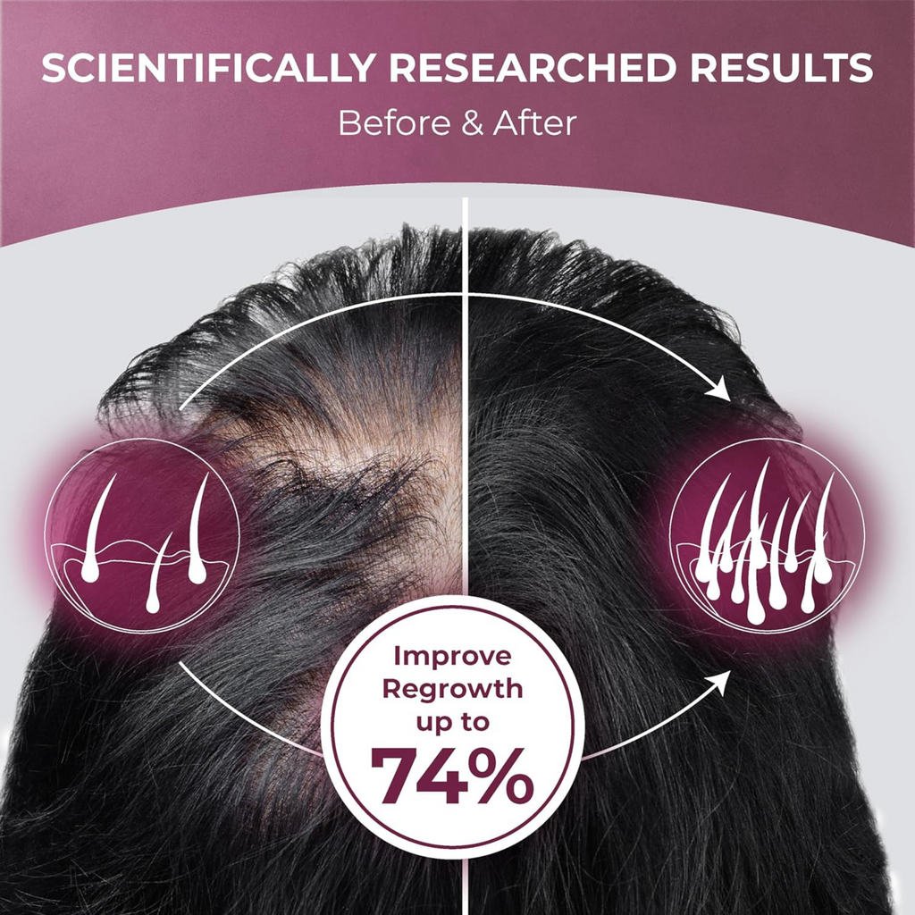 ReGrow Hair Growth Vitamins – Biotin, Saw Palmetto, Collagen, Zinc & More – Hair Supplements for Women & Men – 120 Capsules