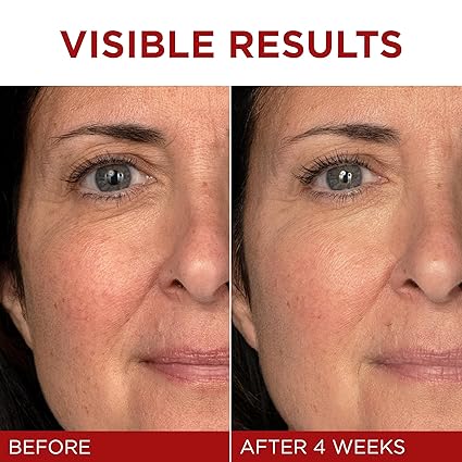 L'Oreal Paris Revitalift Triple Power Anti-Aging Face Moisturizer | Pro-Retinol, Hyaluronic Acid &amp; Vitamin C | 1.7 oz