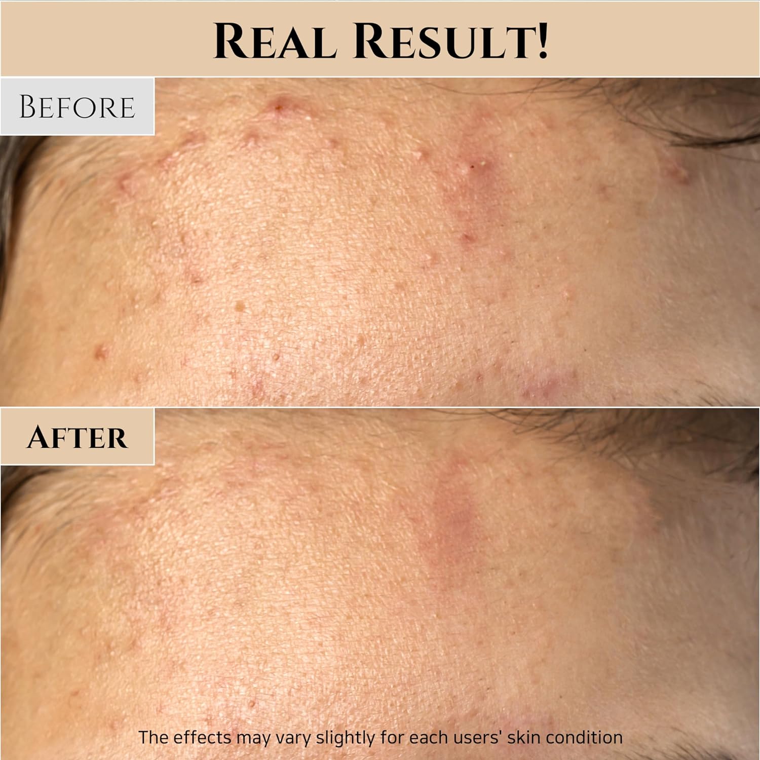 Beauty of Joseon Ground Rice and Honey Glow Mask Pore & Sebum Care | 150ml (5.07 fl. oz) - Ballimart