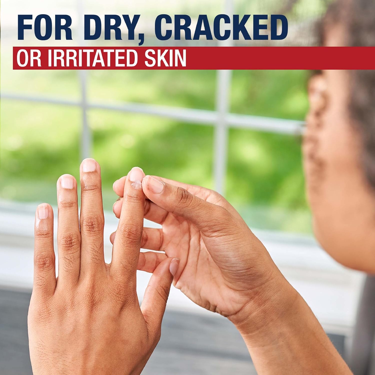 Aquaphor Healing Ointment, Advanced Therapy Skin Protectant – 14 Oz Jar | Multi-Purpose Solution for Dry, Cracked Skin, Minor Cuts & Burns - Ballimart