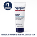 Aquaphor Baby Healing Ointment – Advanced Therapy for Dry Skin & Diaper Rash, Multi-Purpose Skin Protectant, 7 Oz Tube