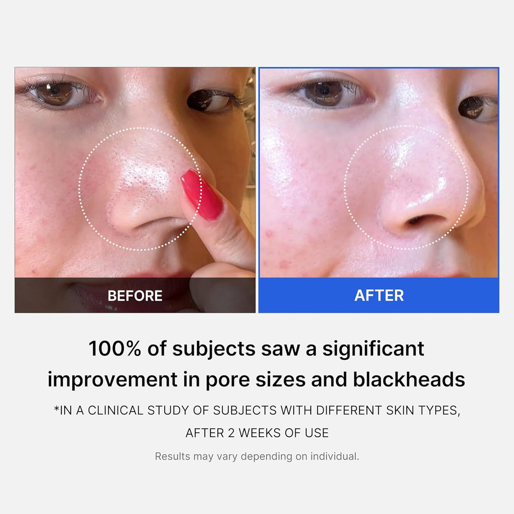 Medicube Zero Pore Pads 2.0 | Dual-Textured Toner Pads with AHA & BHA | Exfoliates, Refines Pores, and Controls Sebum | Korean Skin Care (70 Pads)