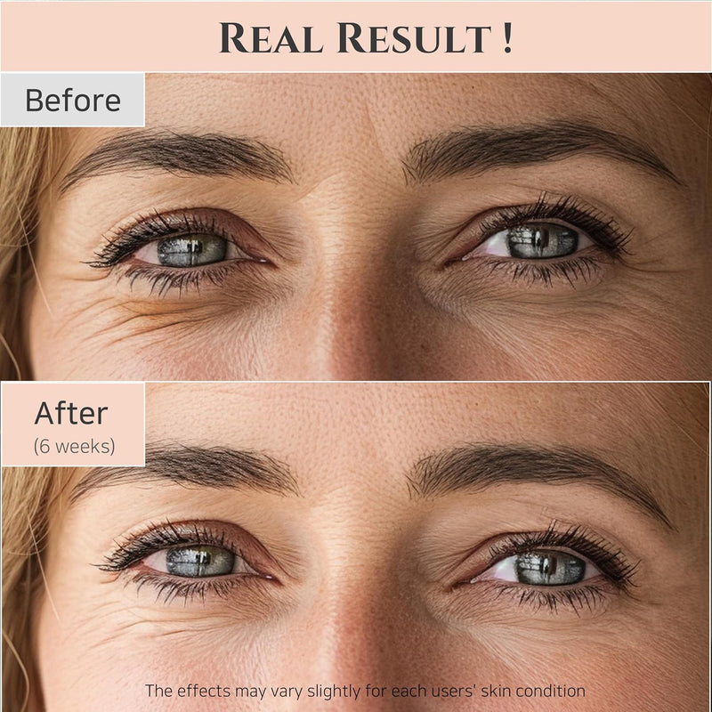 Beauty of Joseon Revive Eye Serum with Retinal & Niacinamide – 30ml (1 fl.oz) | Korean Anti-Aging Eye Care for Dark Circles, Fine Lines, & Wrinkles