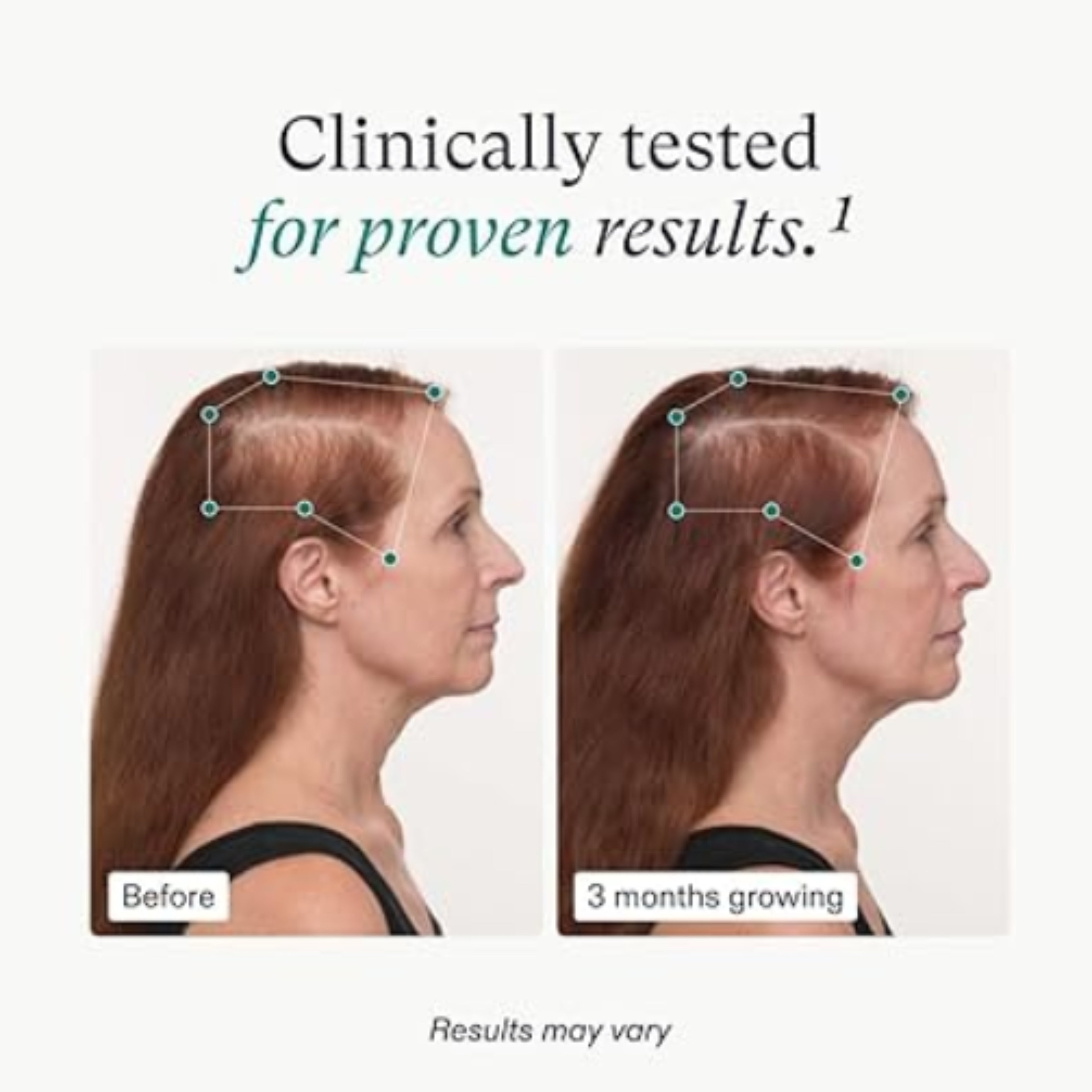 Nutrafol Women's Hair Growth Supplements, Ages 18-44, Clinically Proven, 1-Month Supply - Ballimart