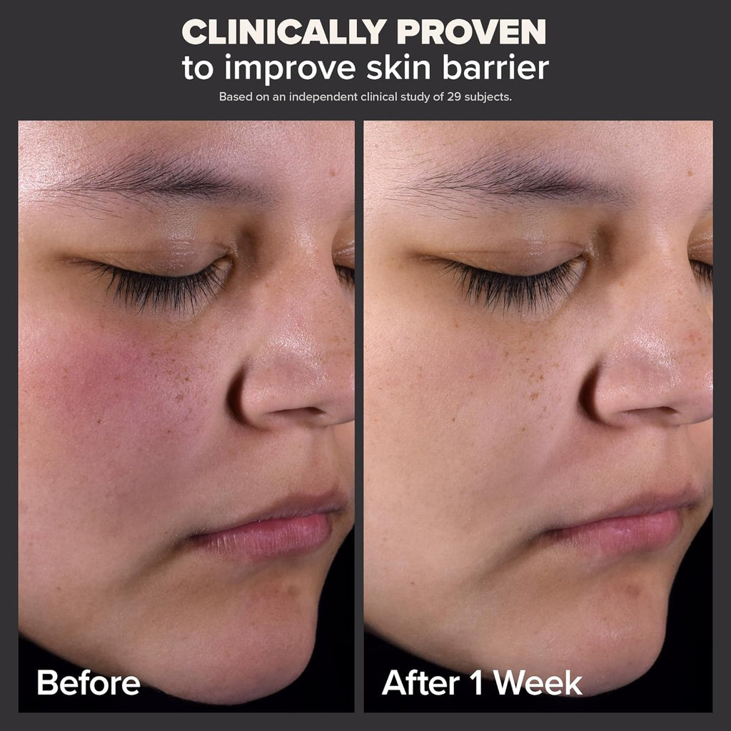 Paula's Choice SKIN PERFECTING 2% BHA Liquid Exfoliant - Clear Pores, Fight Wrinkles, & Smooth Skin - Ballimart