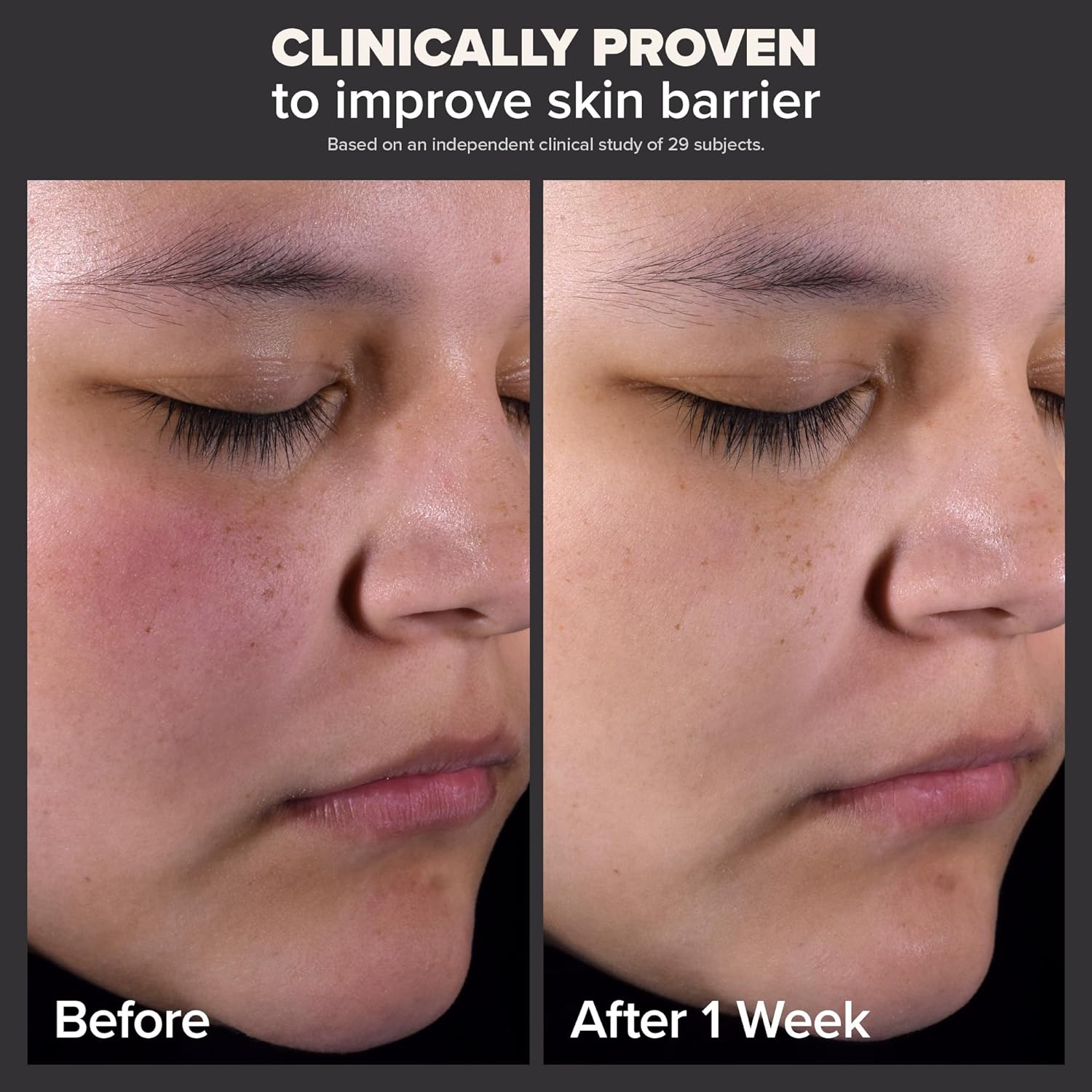 Paula's Choice SKIN PERFECTING 2% BHA Liquid Exfoliant - Clear Pores, Fight Wrinkles, & Smooth Skin - Ballimart